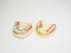 ・
                    菅野歯科医院・調整完了、患者さんへお戻しする